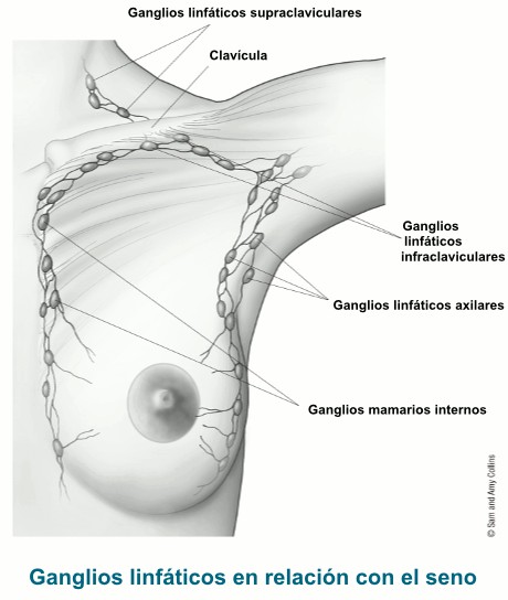 ganglios-linfaticos-cancer-de-mama